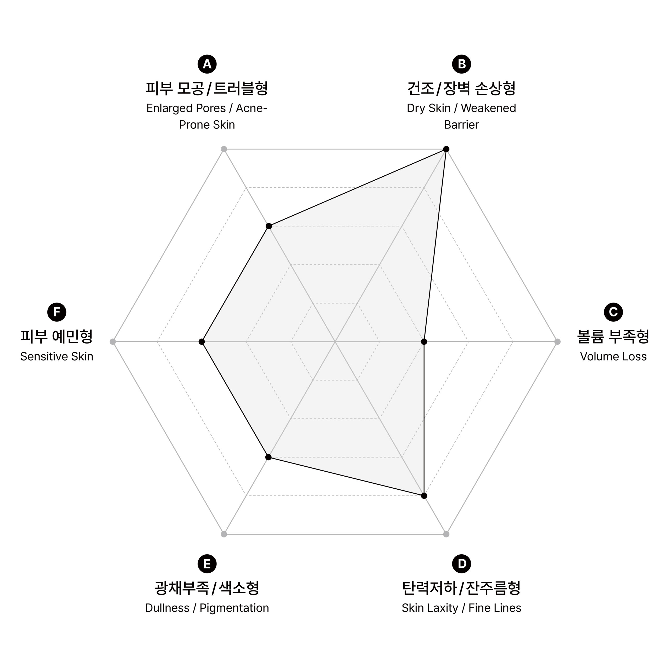 시술 원리 다이어그램