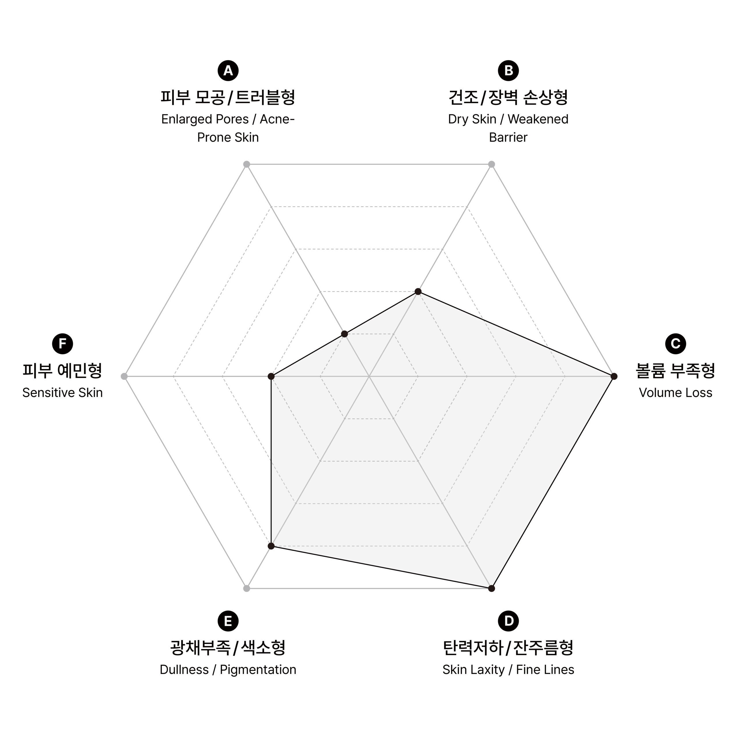 시술 원리 다이어그램