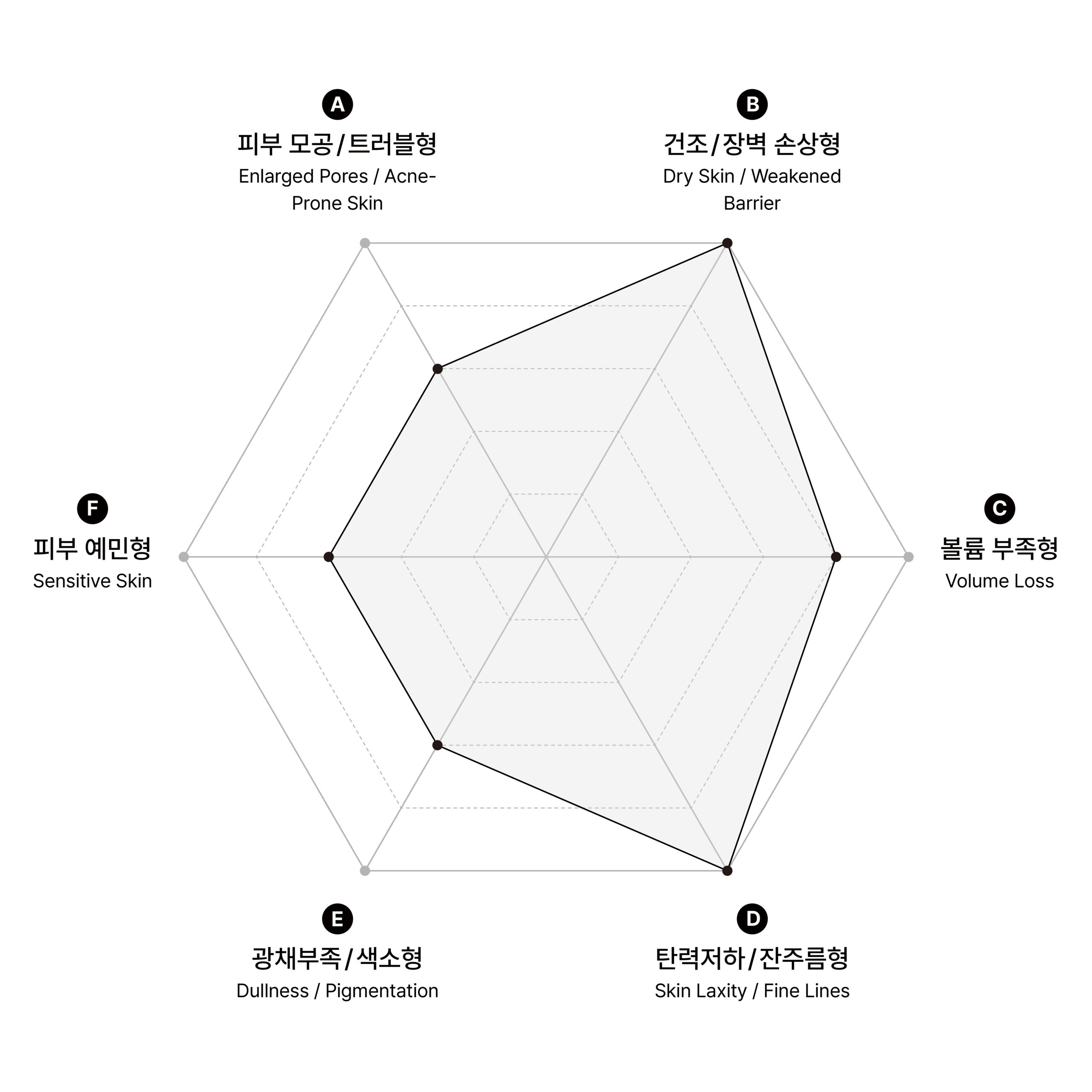 시술 원리 다이어그램