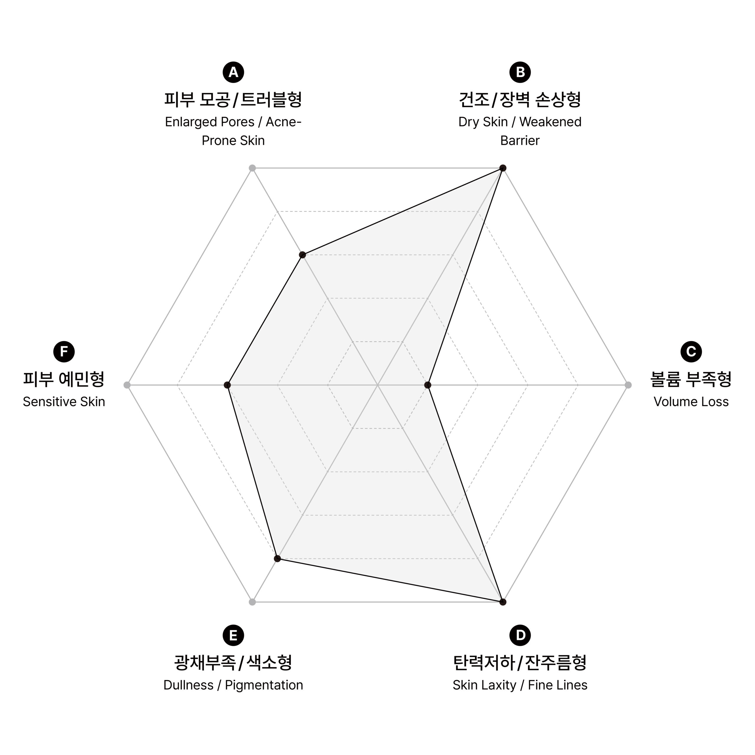 시술 원리 다이어그램