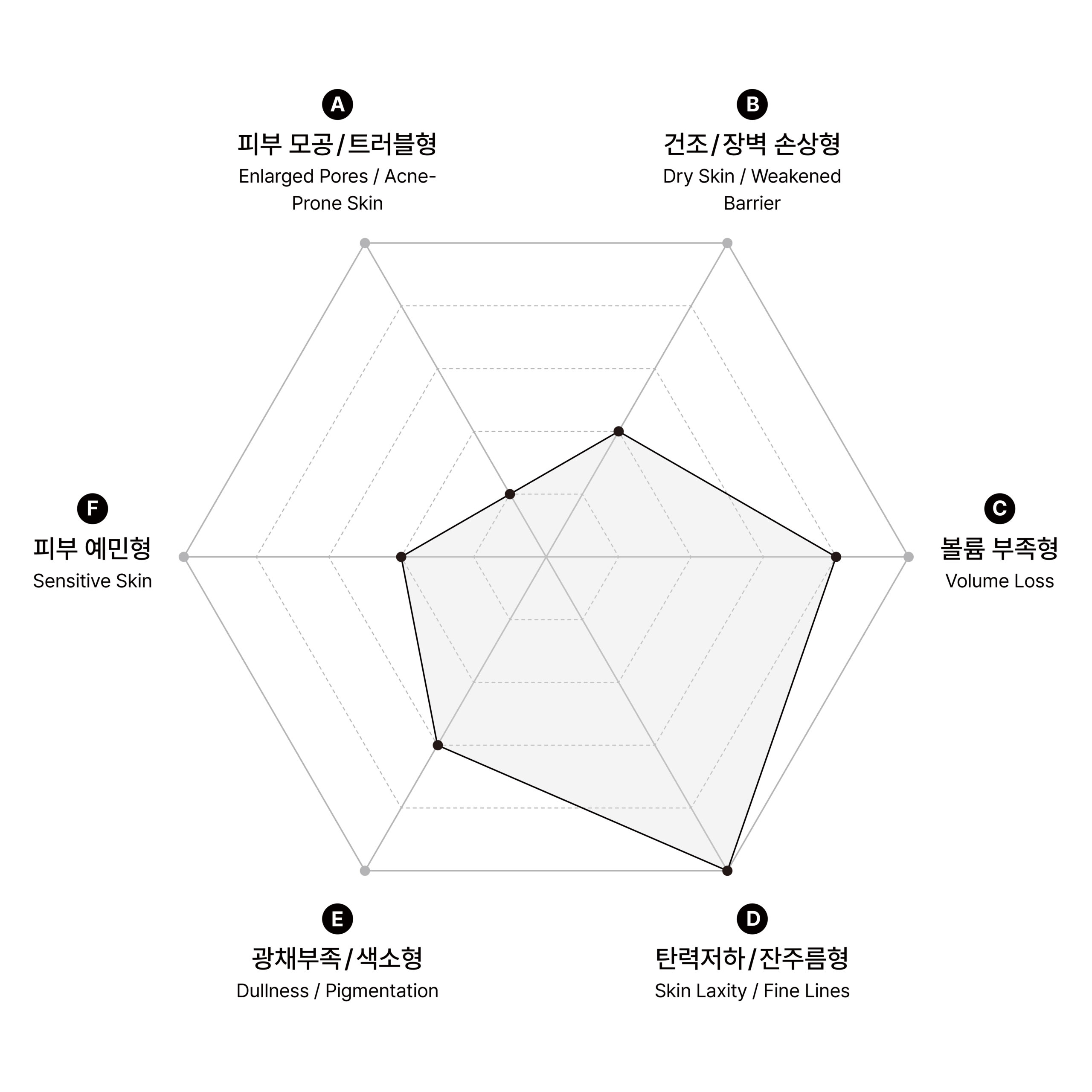 시술 원리 다이어그램