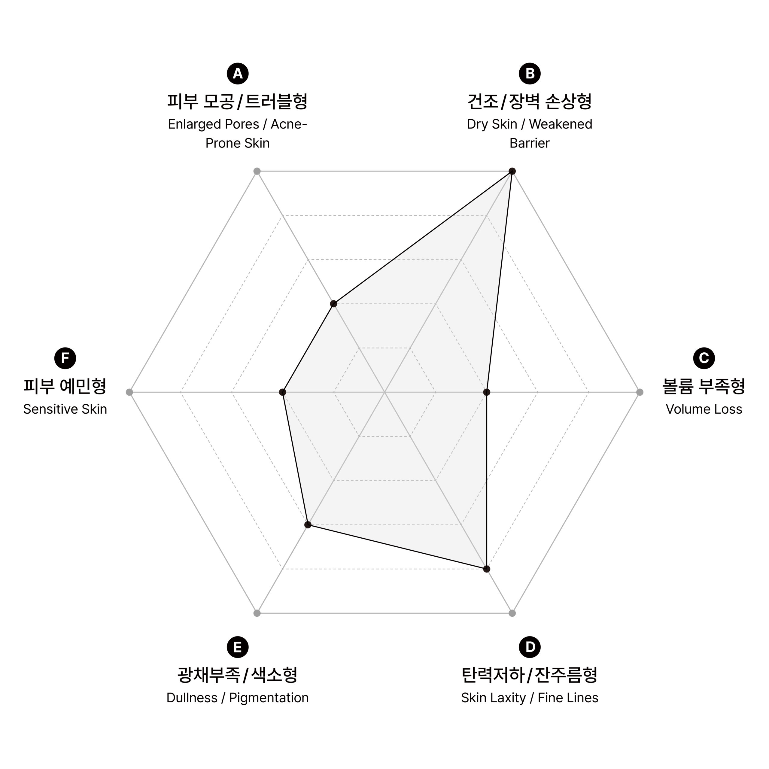 시술 원리 다이어그램