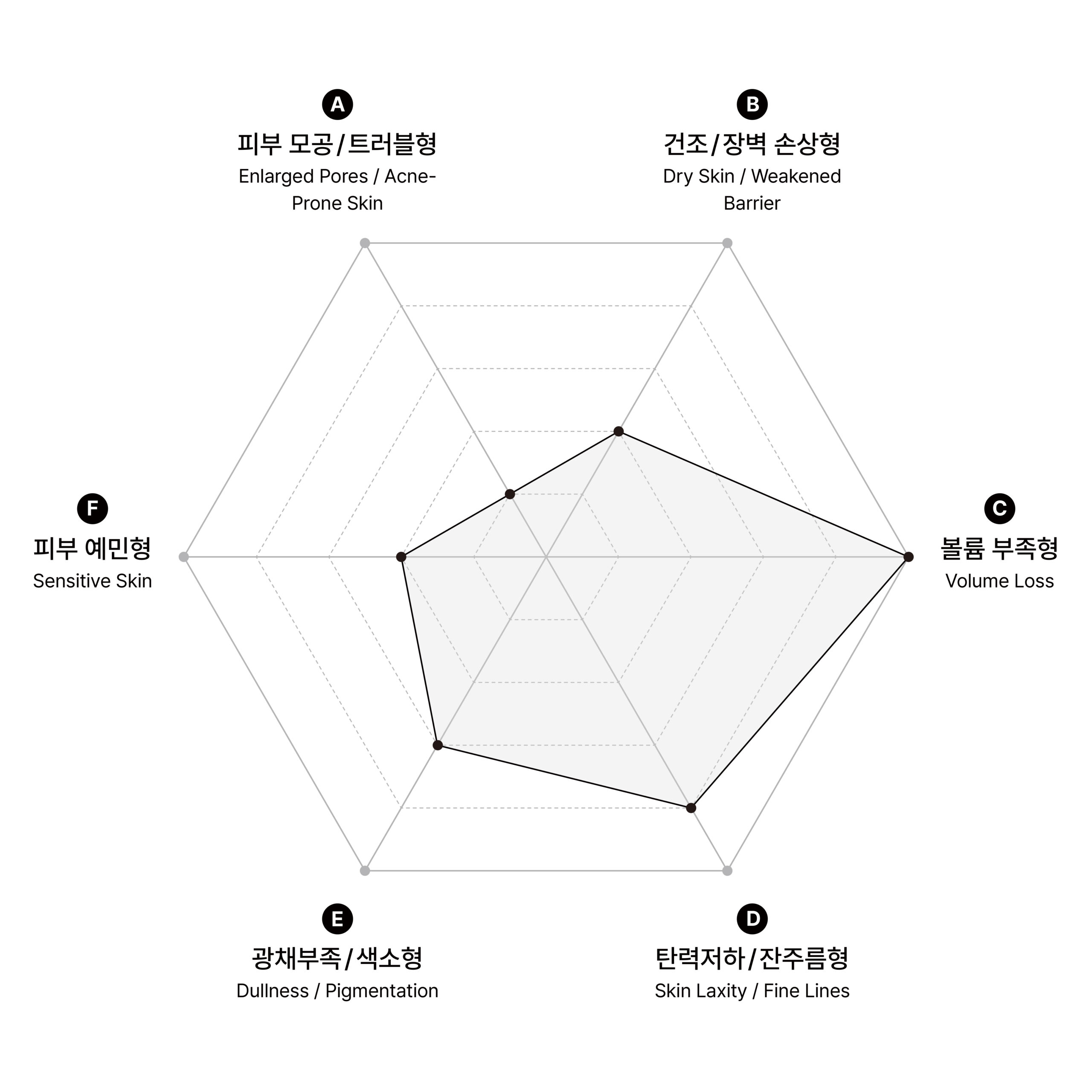 시술 원리 다이어그램