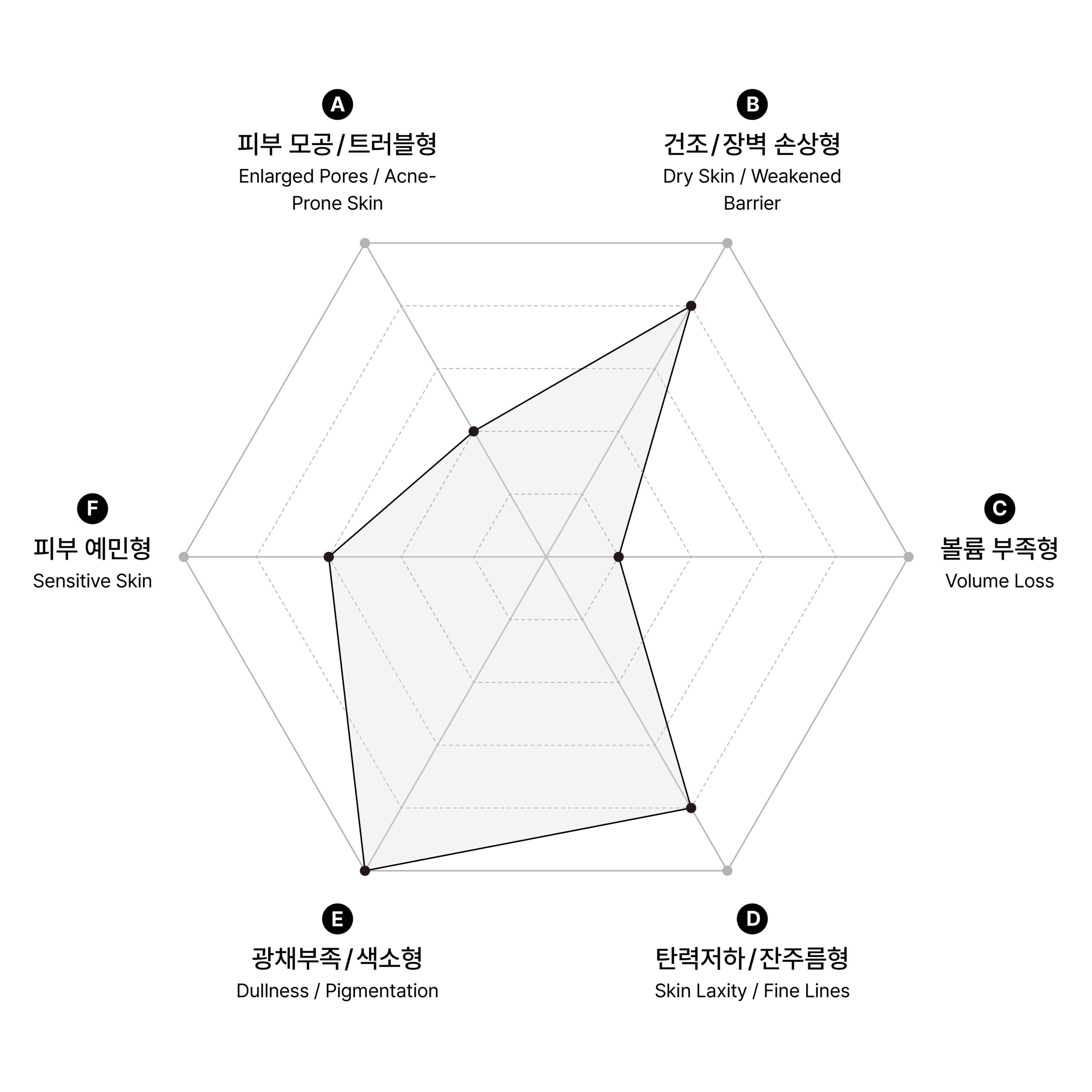 시술 원리 다이어그램