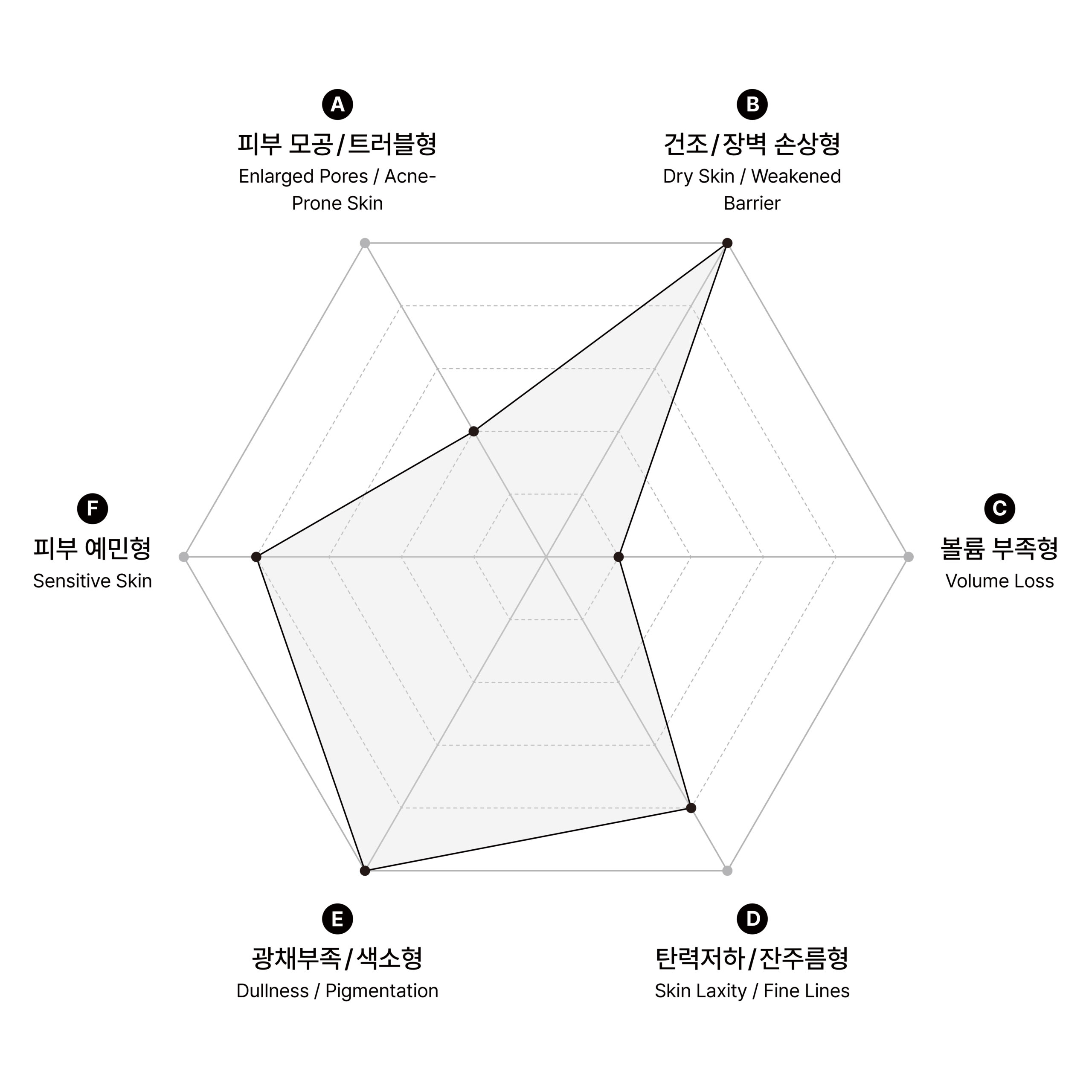 시술 원리 다이어그램