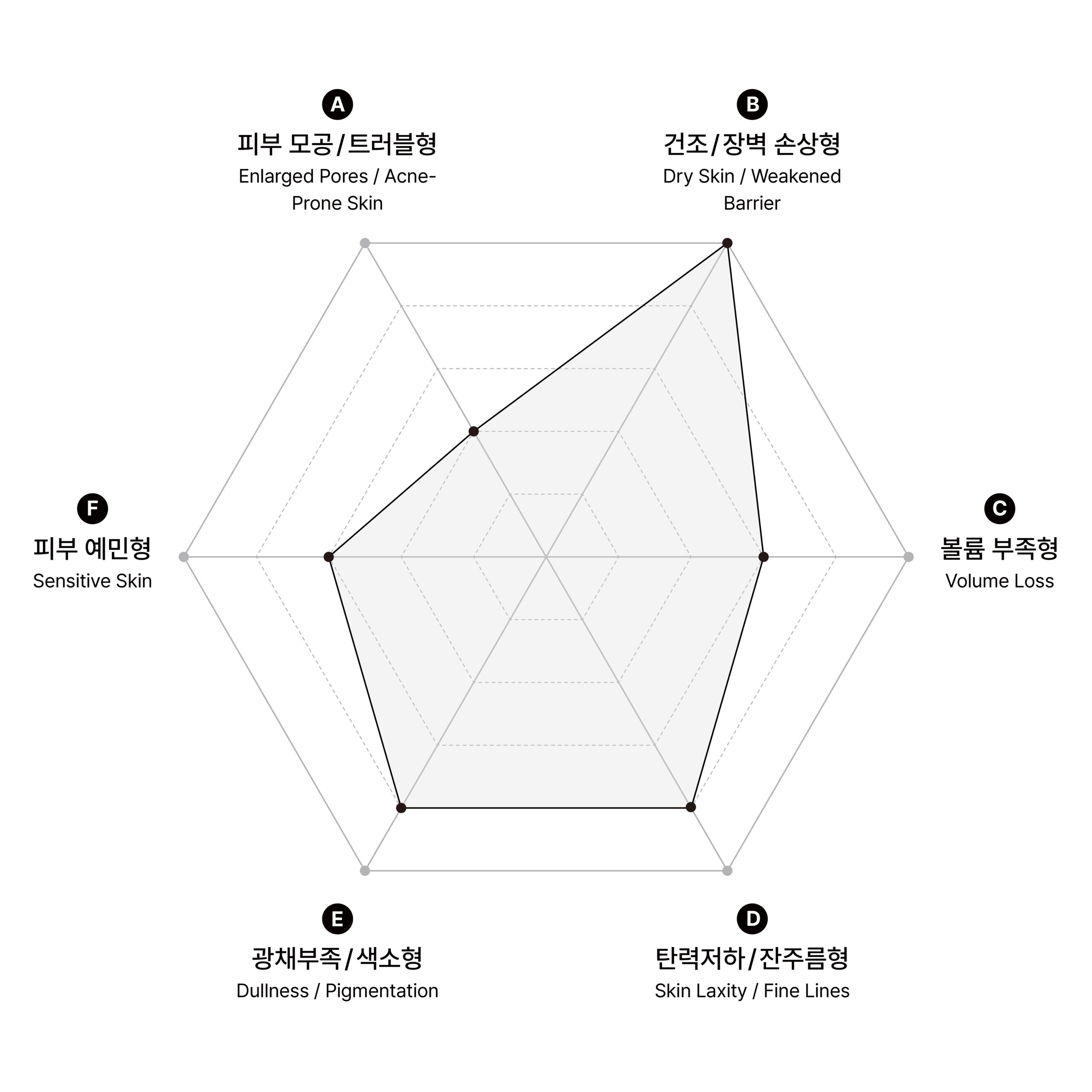 시술 원리 다이어그램