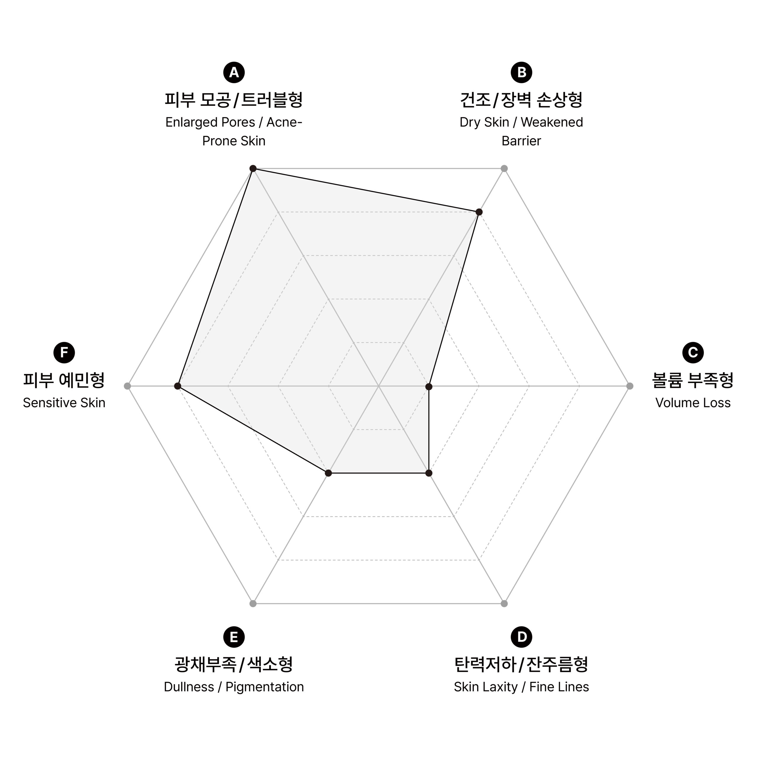 시술 원리 다이어그램