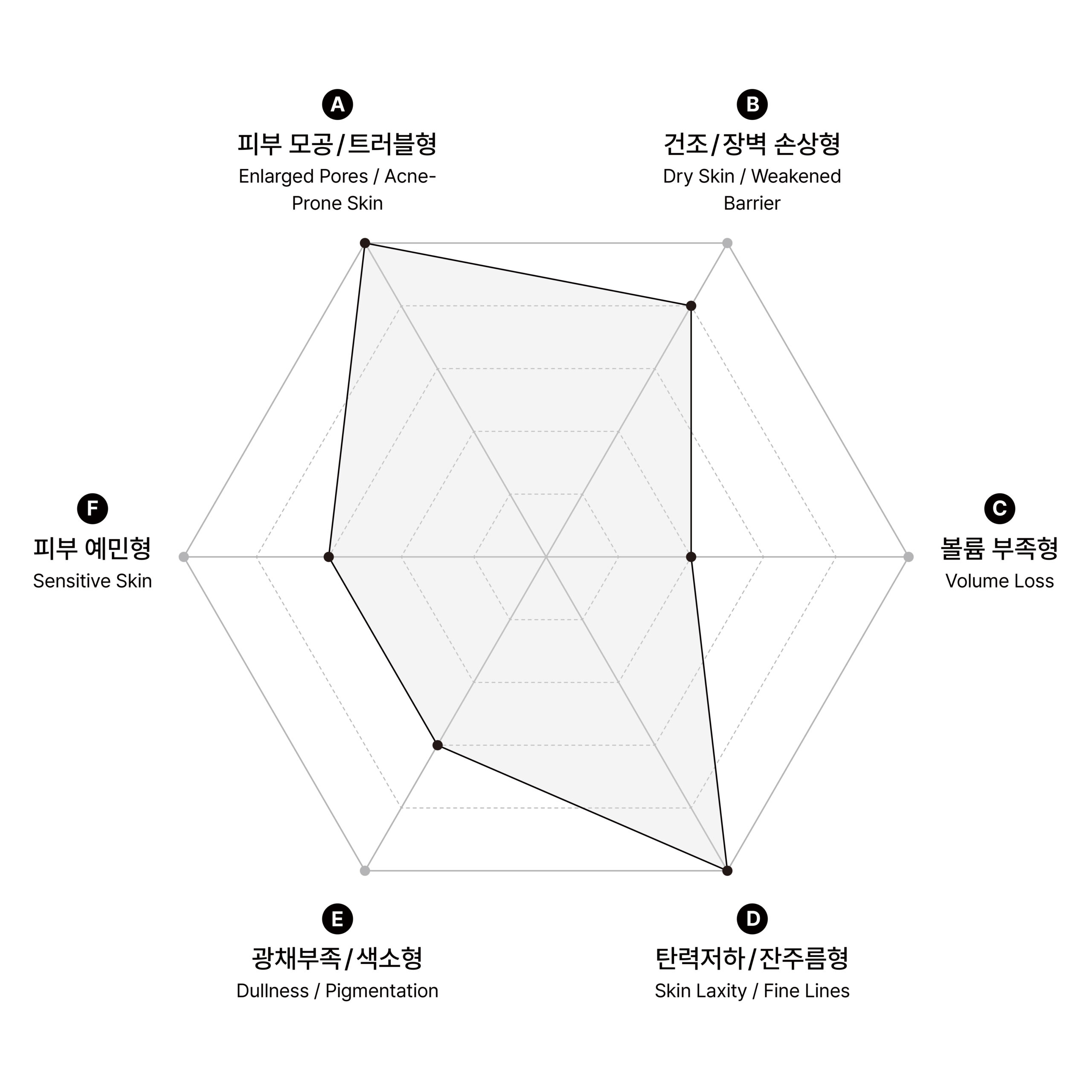 시술 원리 다이어그램