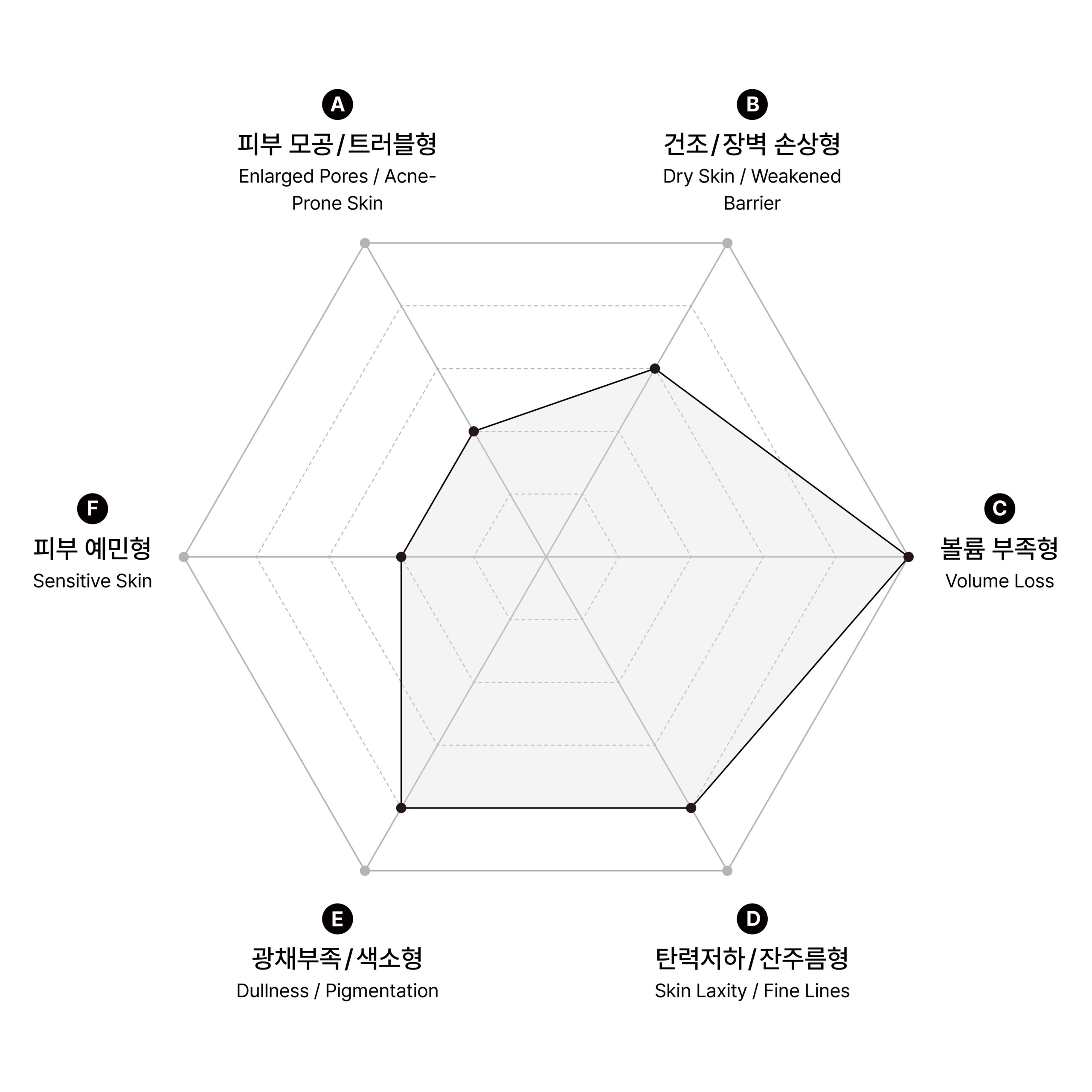시술 원리 다이어그램