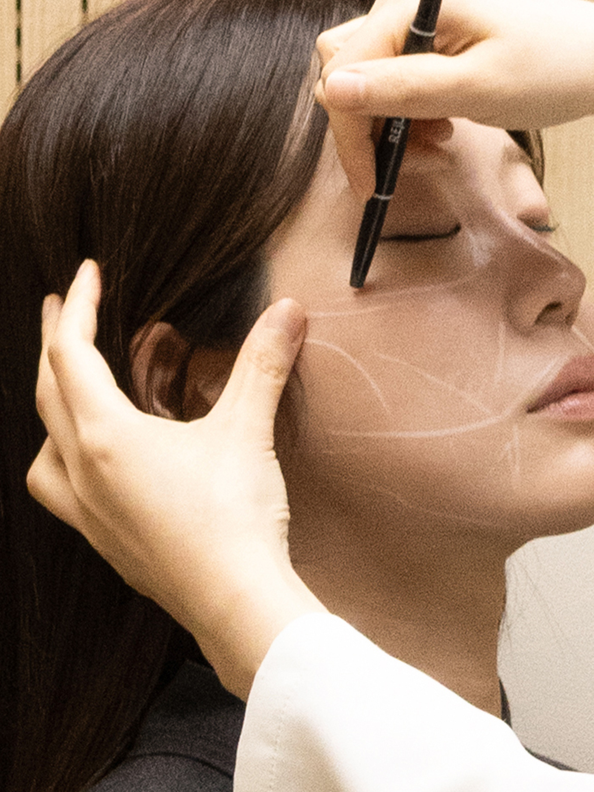 Lifting Sculptra 06
