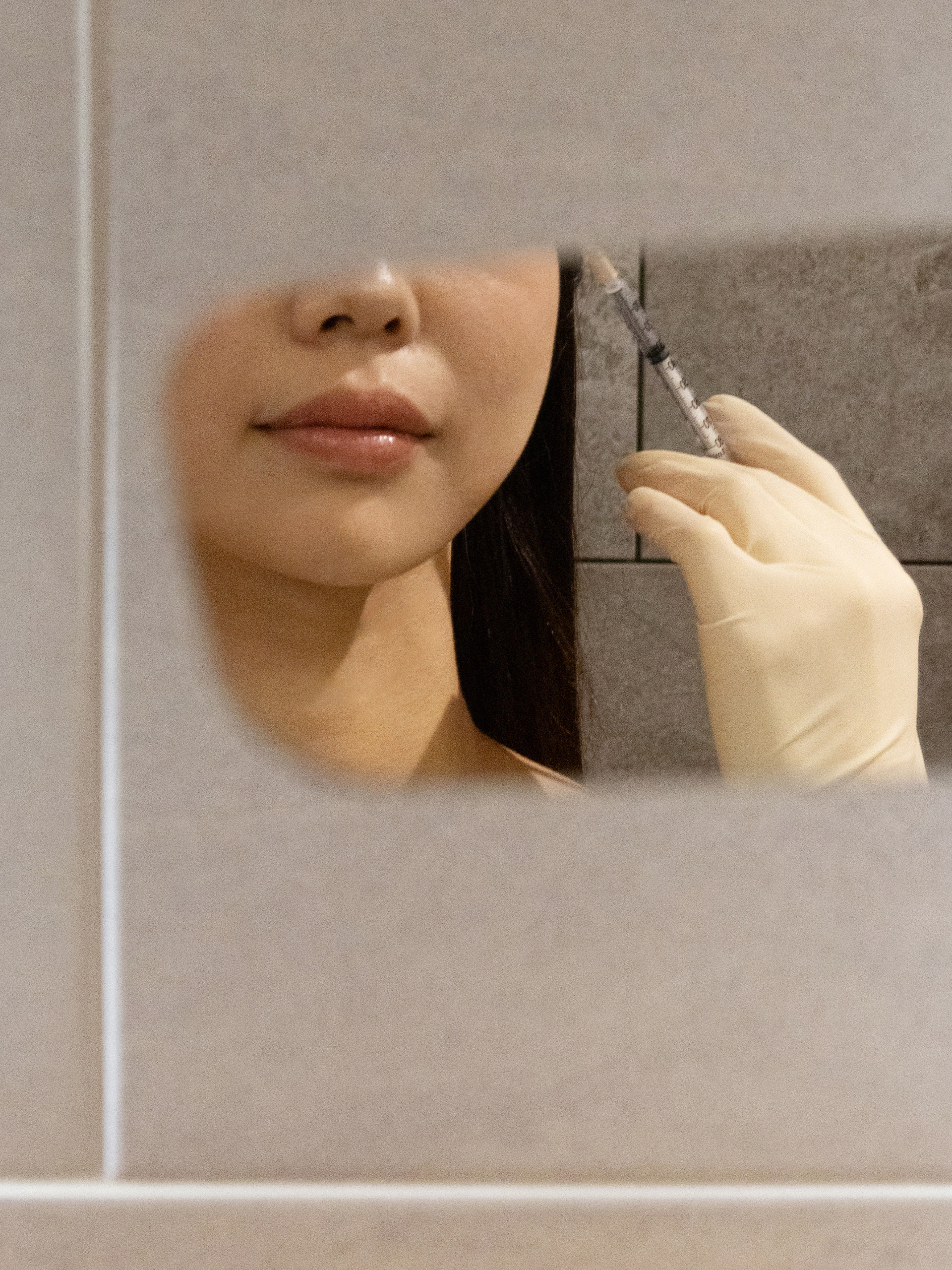 Lifting Botox 03