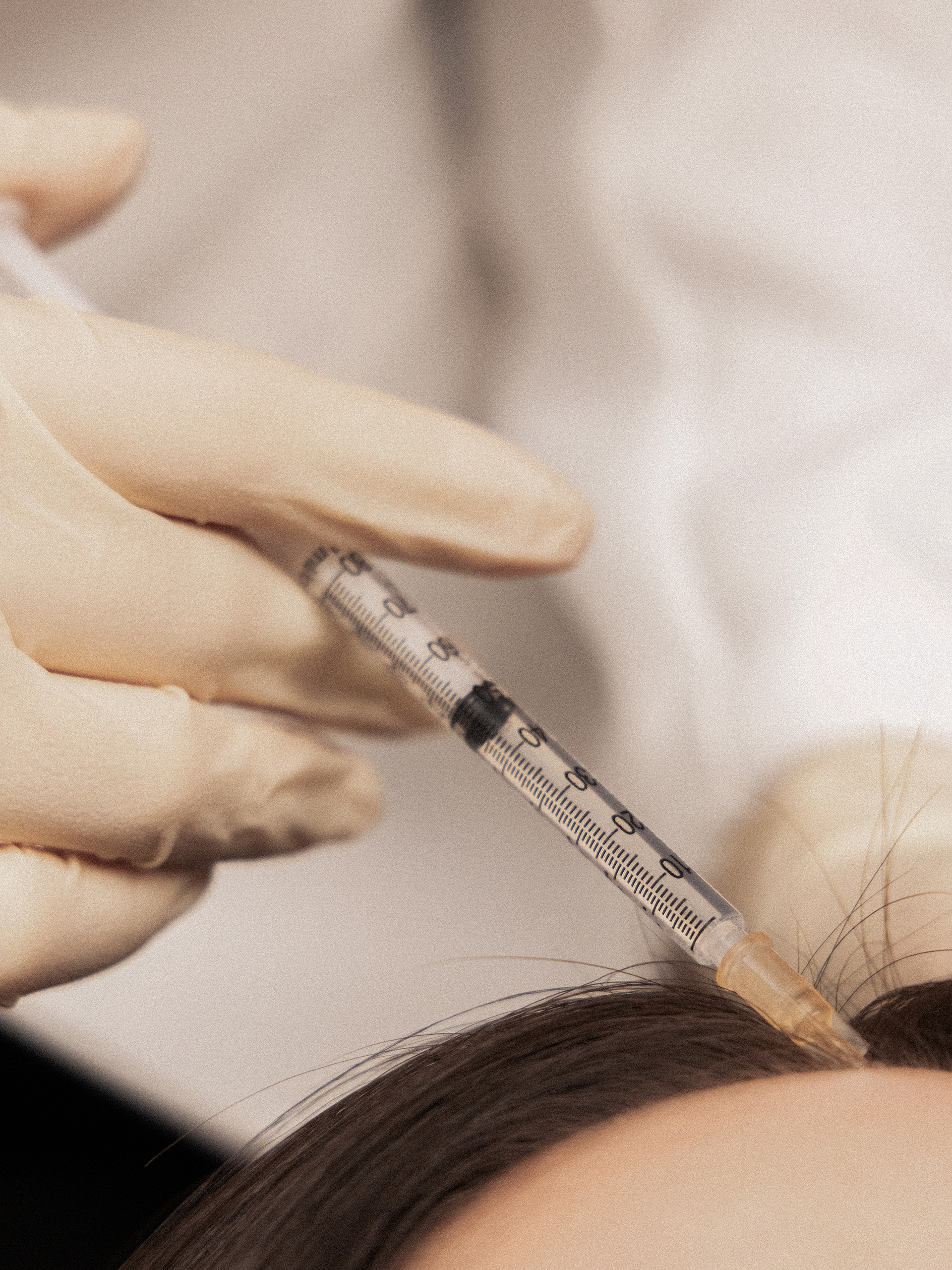 Scalp exosomes 2