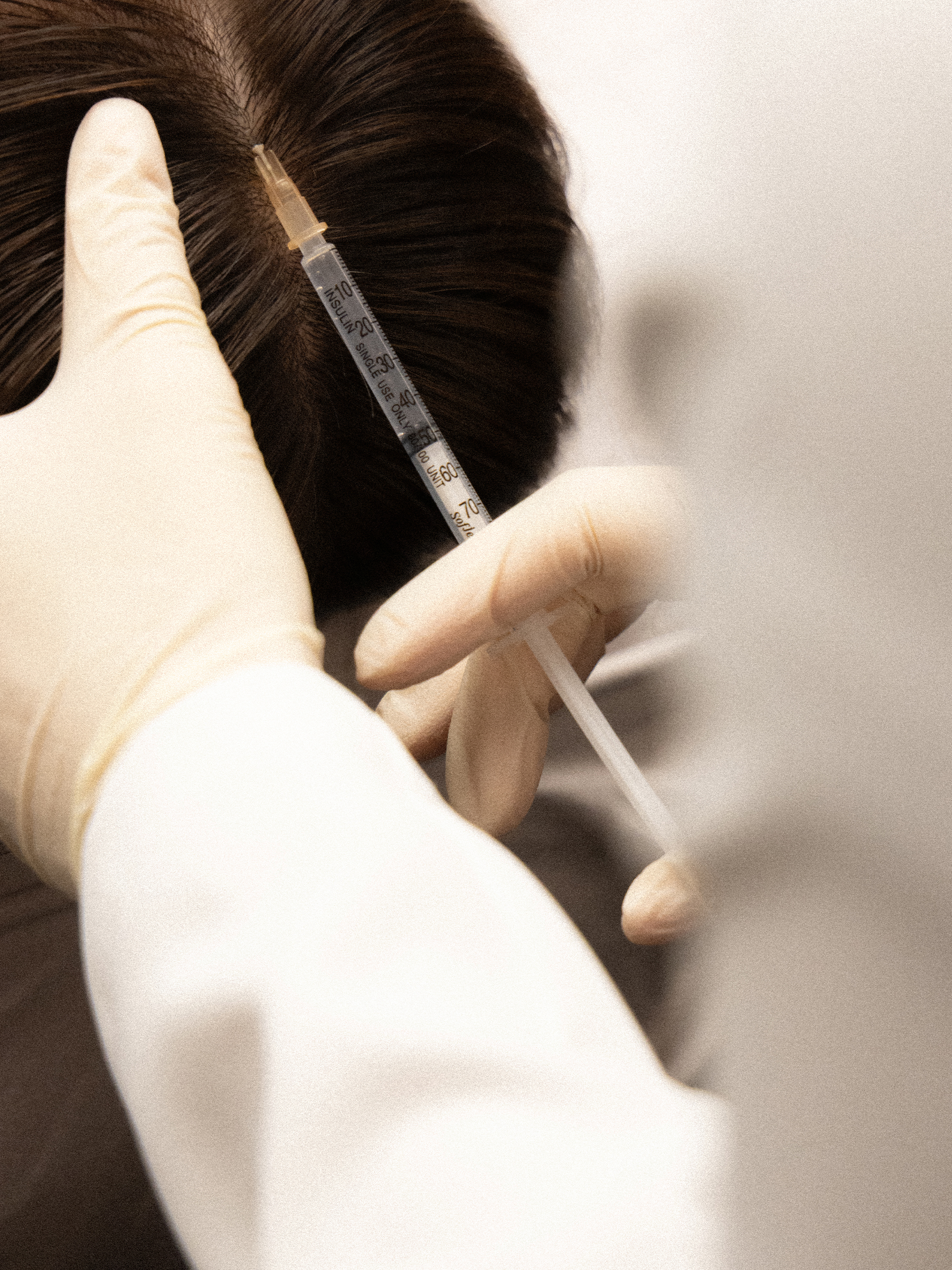 Scalp exosomes 4